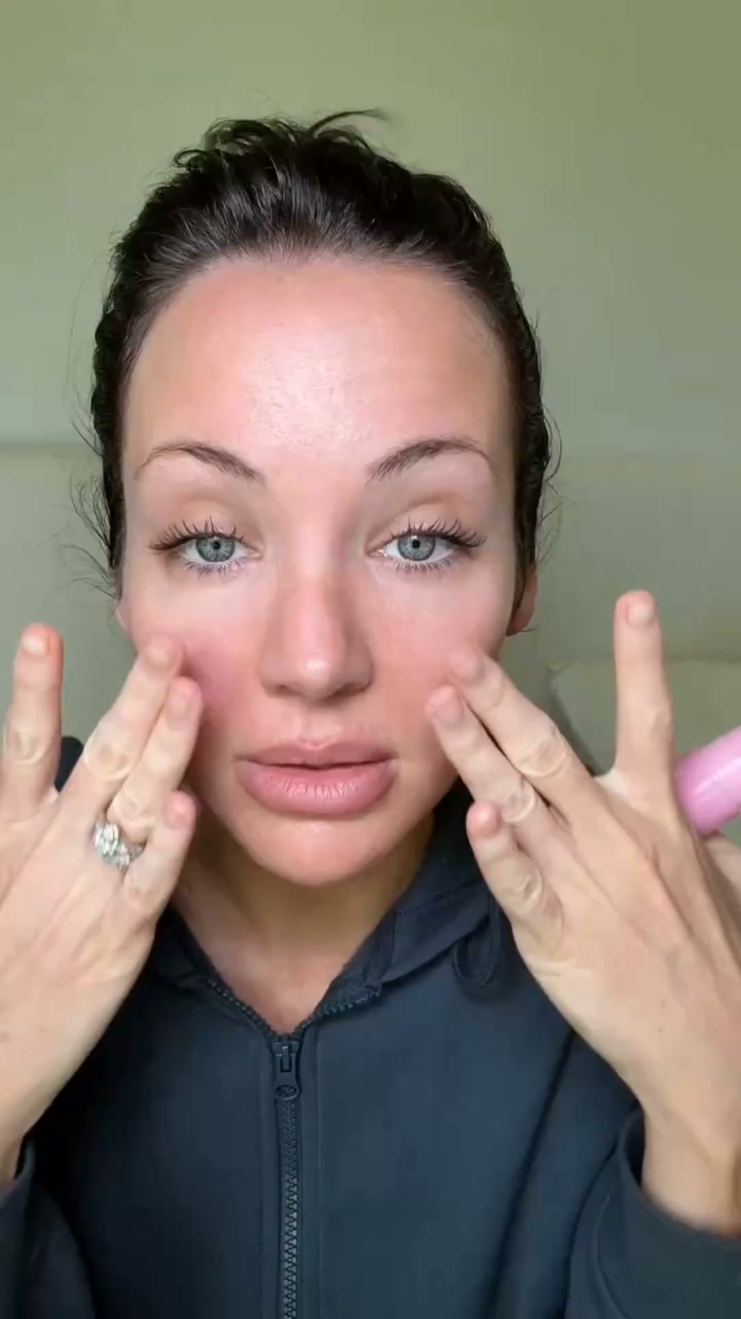 TARGET VOLUME LOSS — NOT JUST WRINKLES