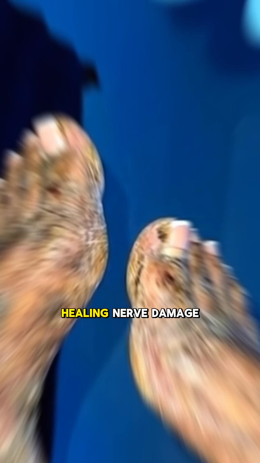 There's Hope for Nerve Damage