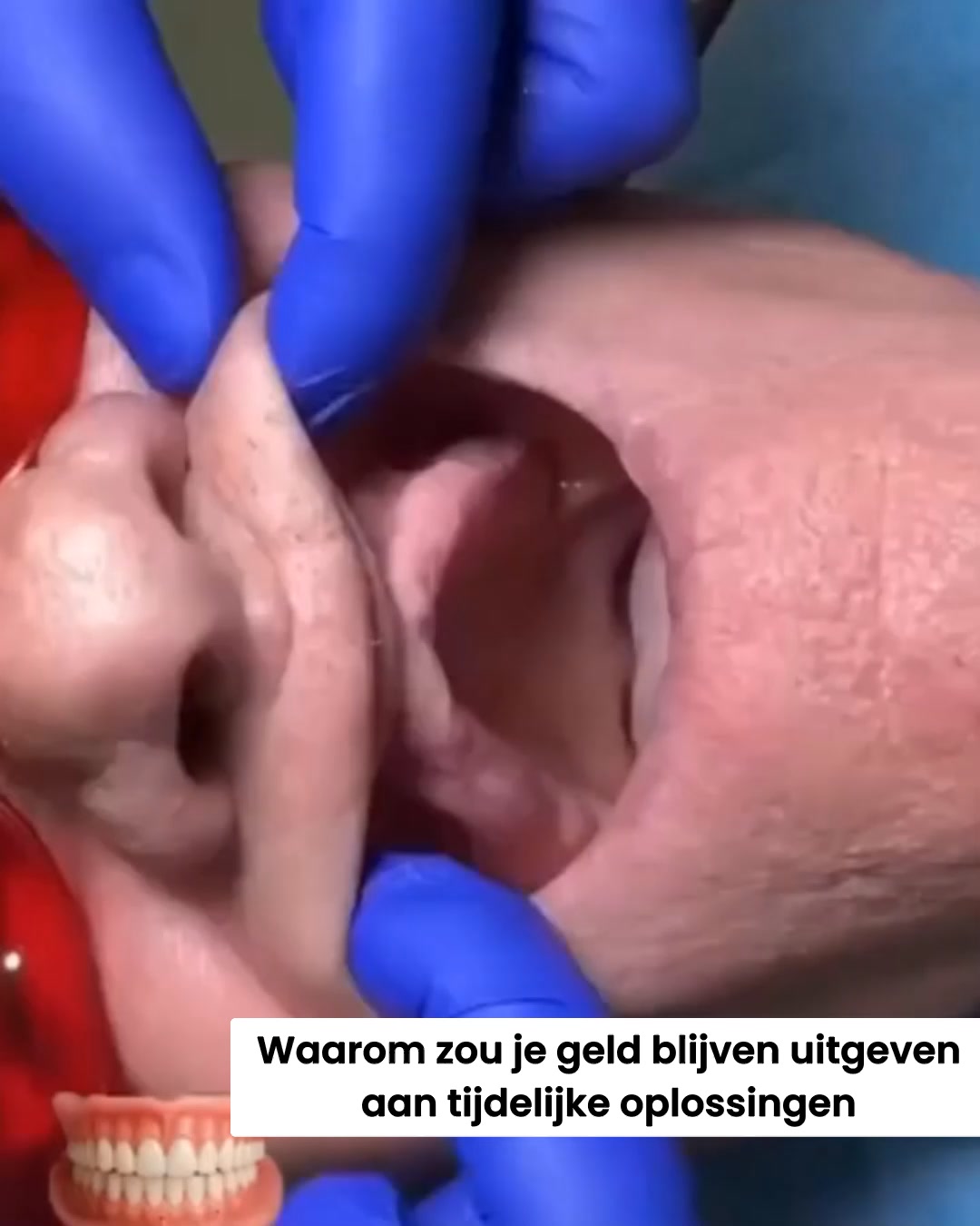 Het ging nooit om tanden
