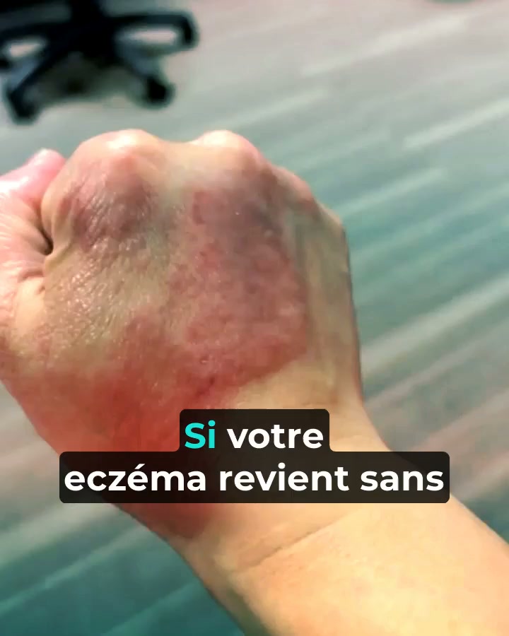 Jusqu’à –50 % sur Psorelia aujourd’hui