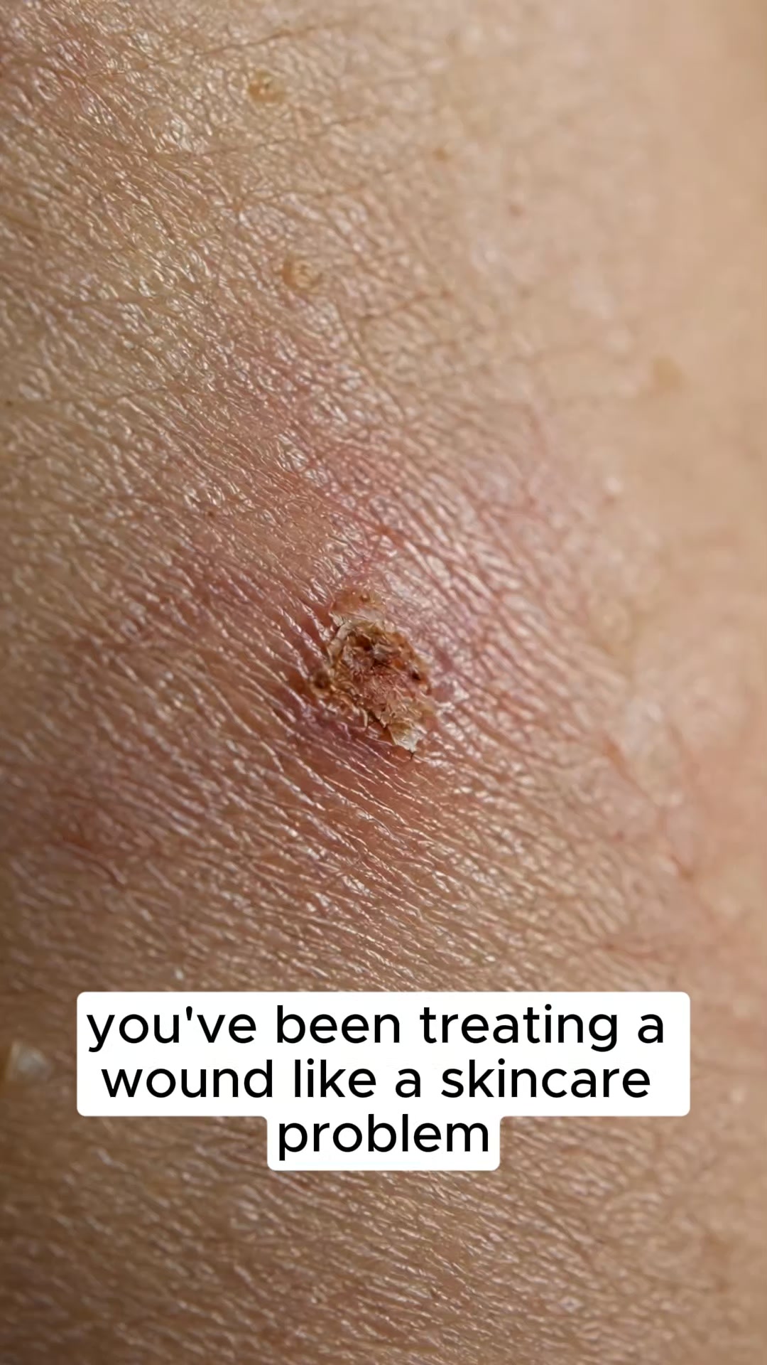 Your Skin Heals Better Without You.