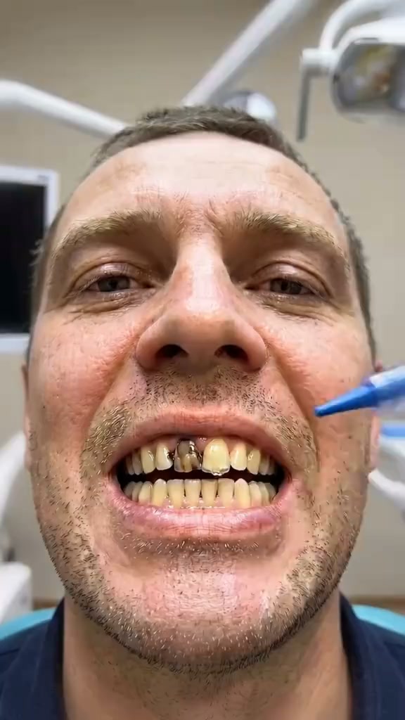 Dentes Mais Brancos