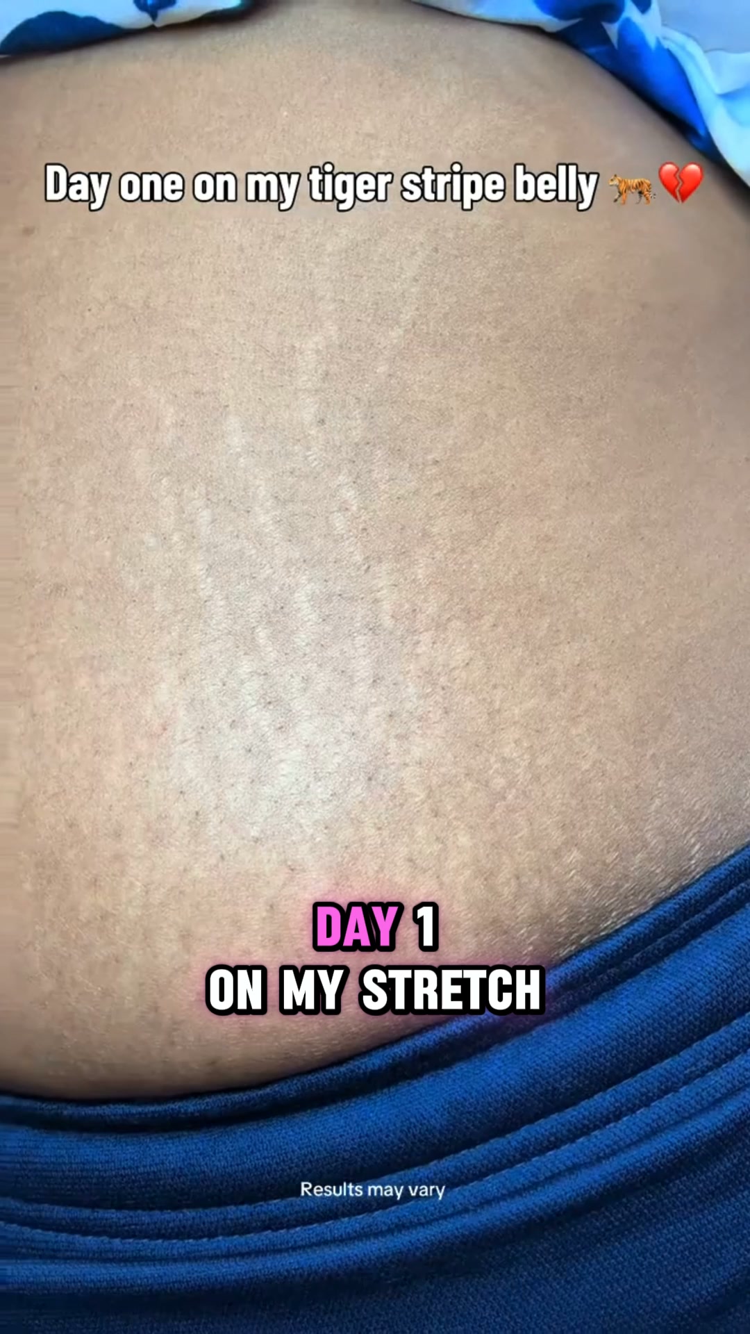 Firmer-Looking Skin in Just Weeks