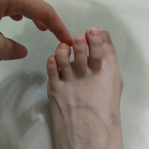 Stop The Pain