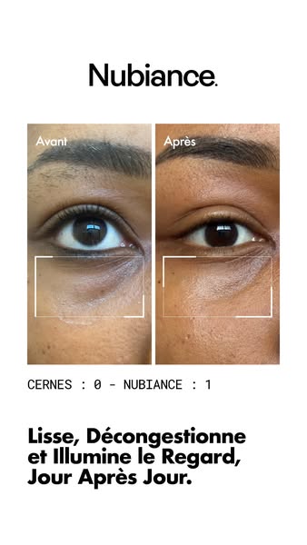 EYE RE-7®