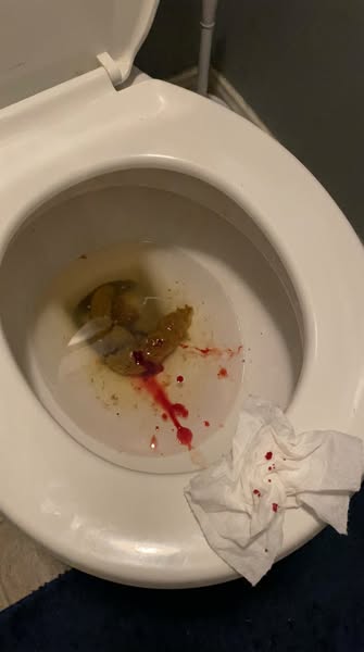 I hadn't gone in 11 days.