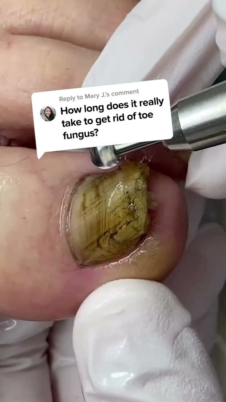 The Real Reason You’re Hiding Feet