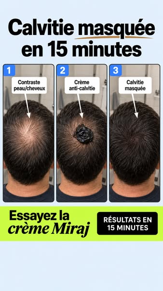 Crème Anti-Calvitie
