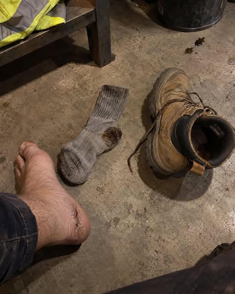 Steel Toes? Read This