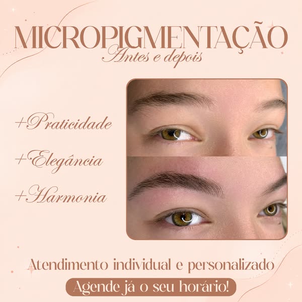 Entenda todos os detalhes