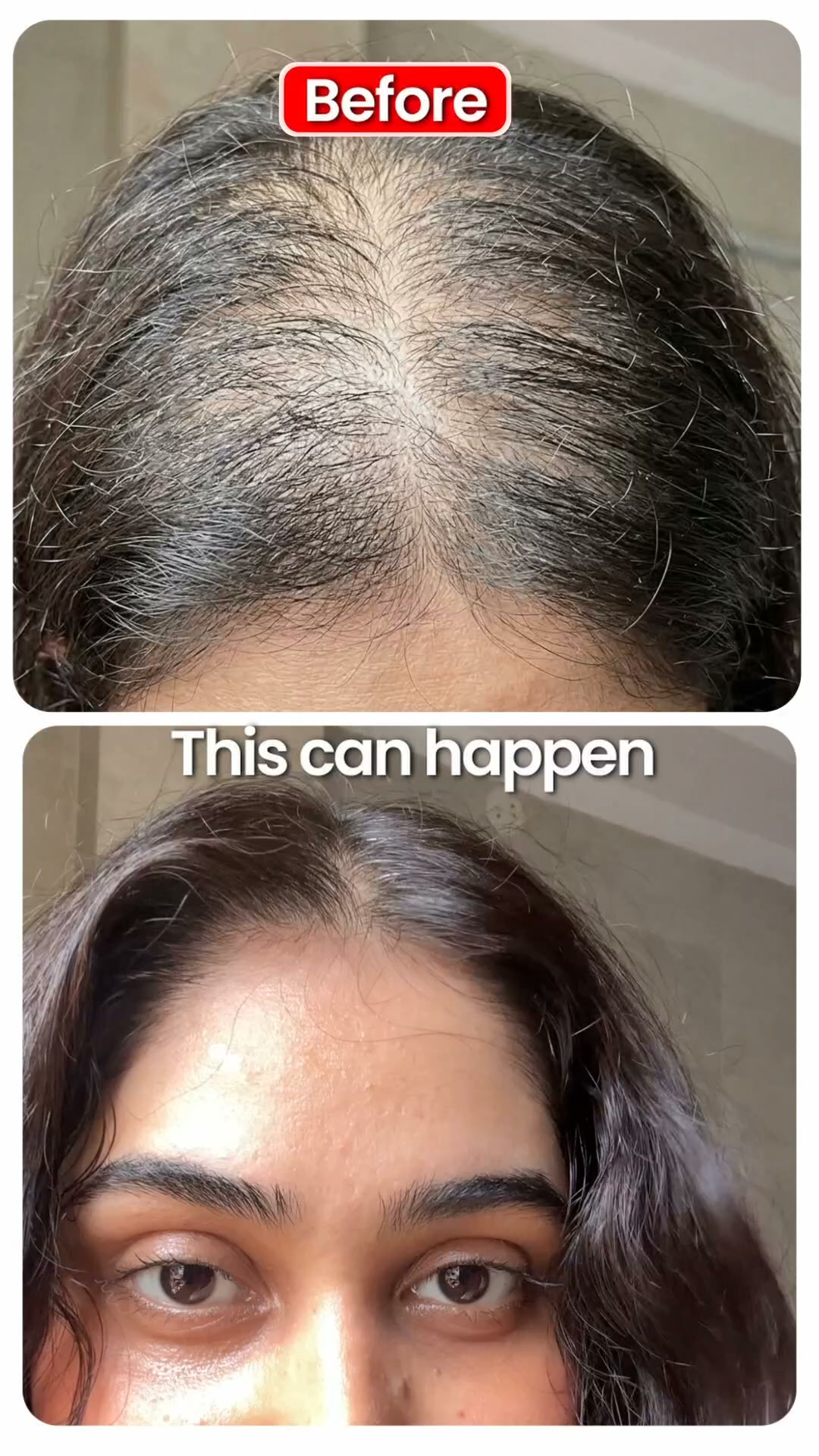 2X more powerful than Minoxidil