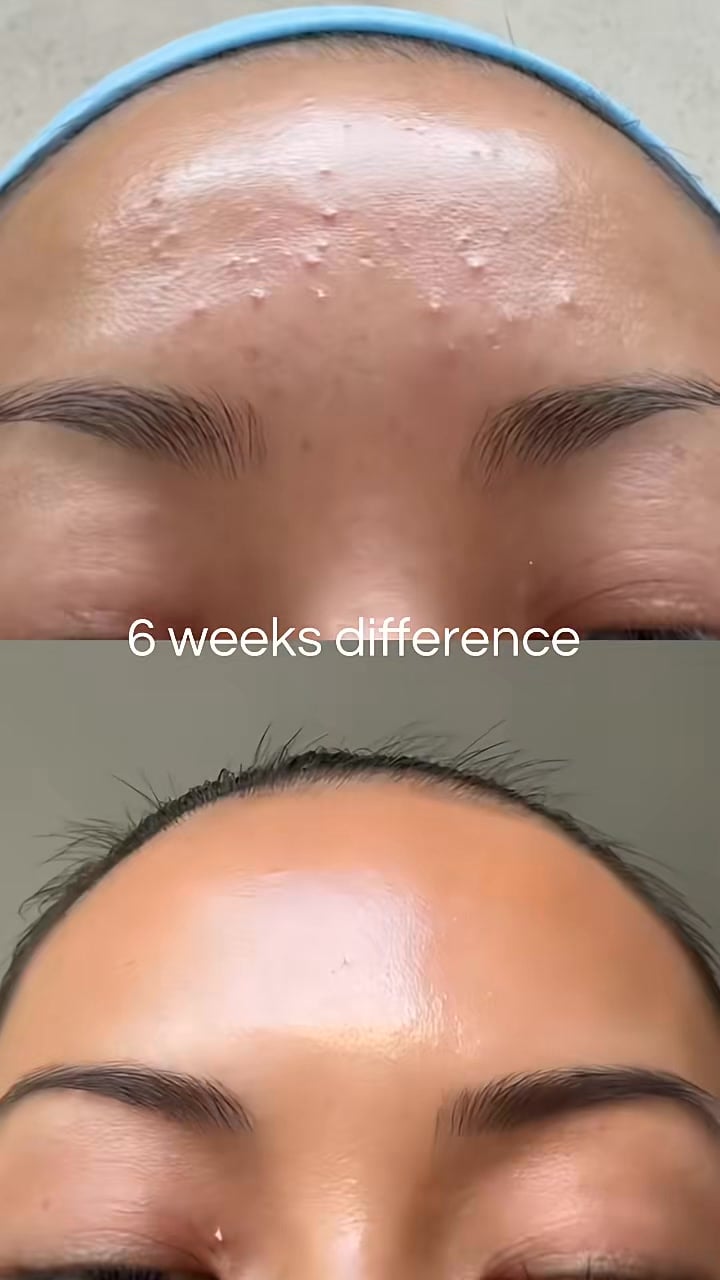 Why Millions Are Using this every Day
