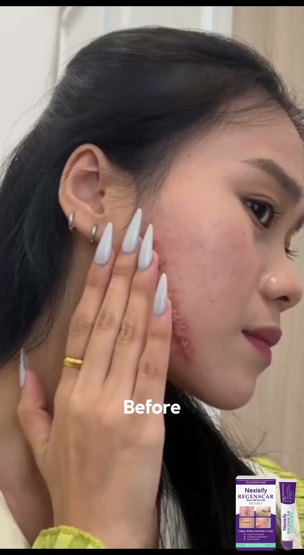 Say Goodbye to Stubborn Old & New Scars