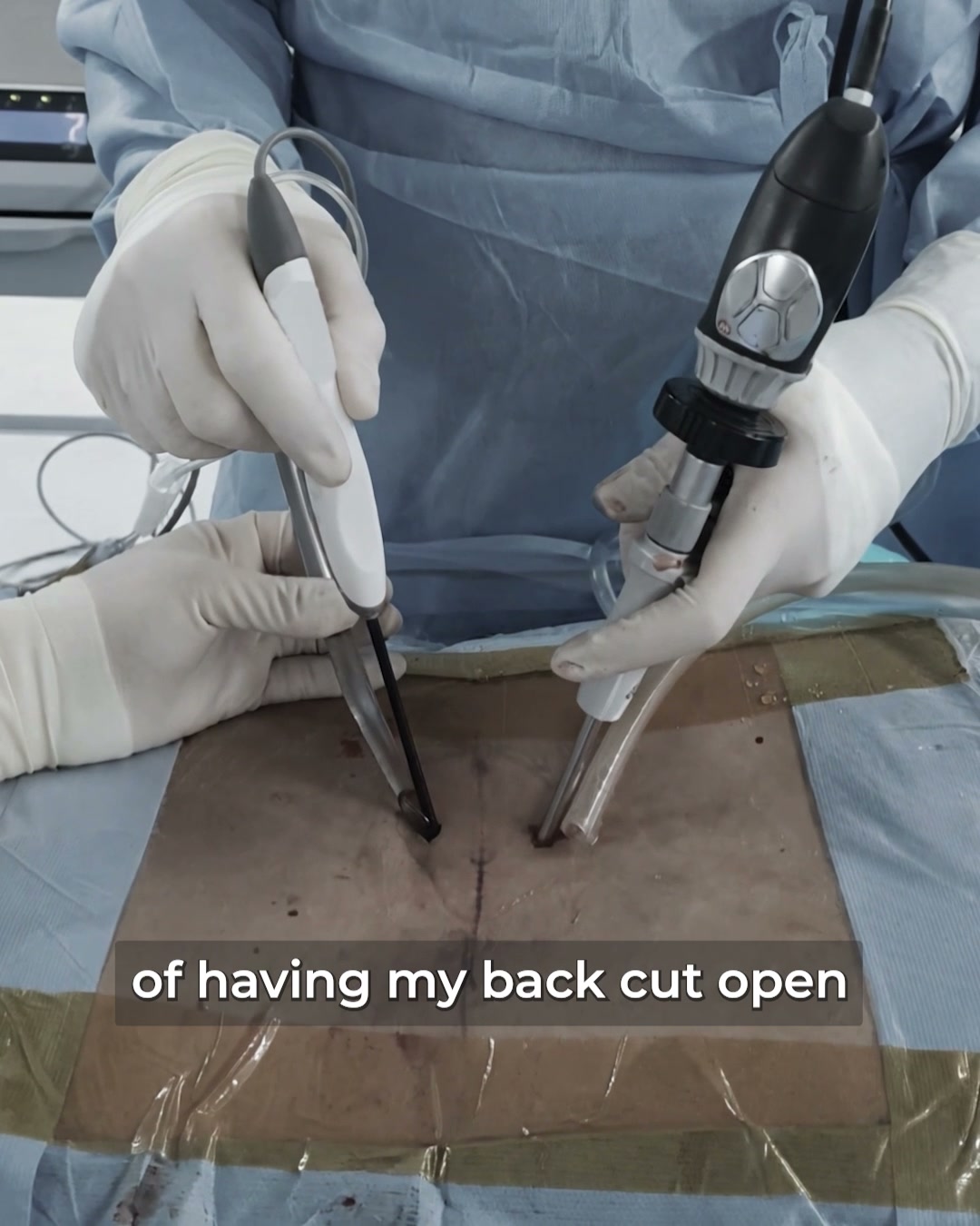 Read This Before Your Sciatica Surgery