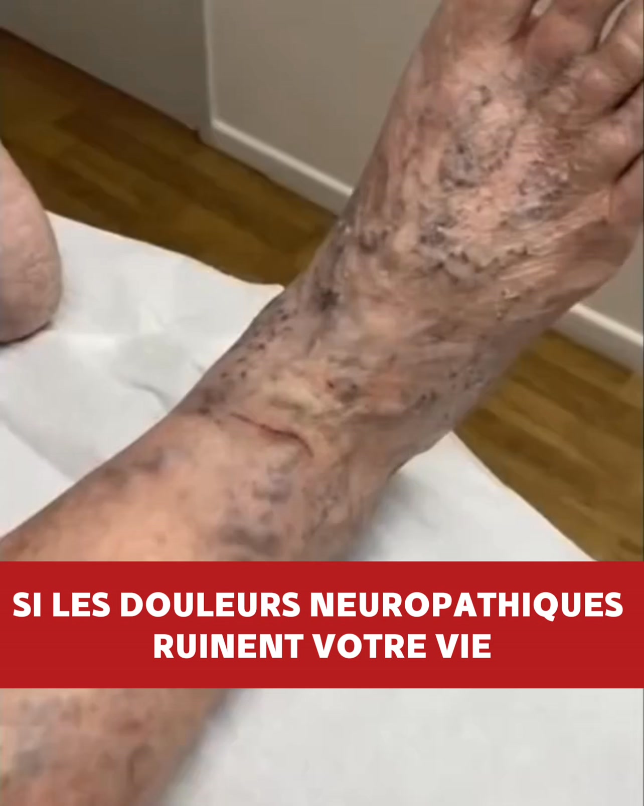 Aide à soulager les douleurs neuropathiques