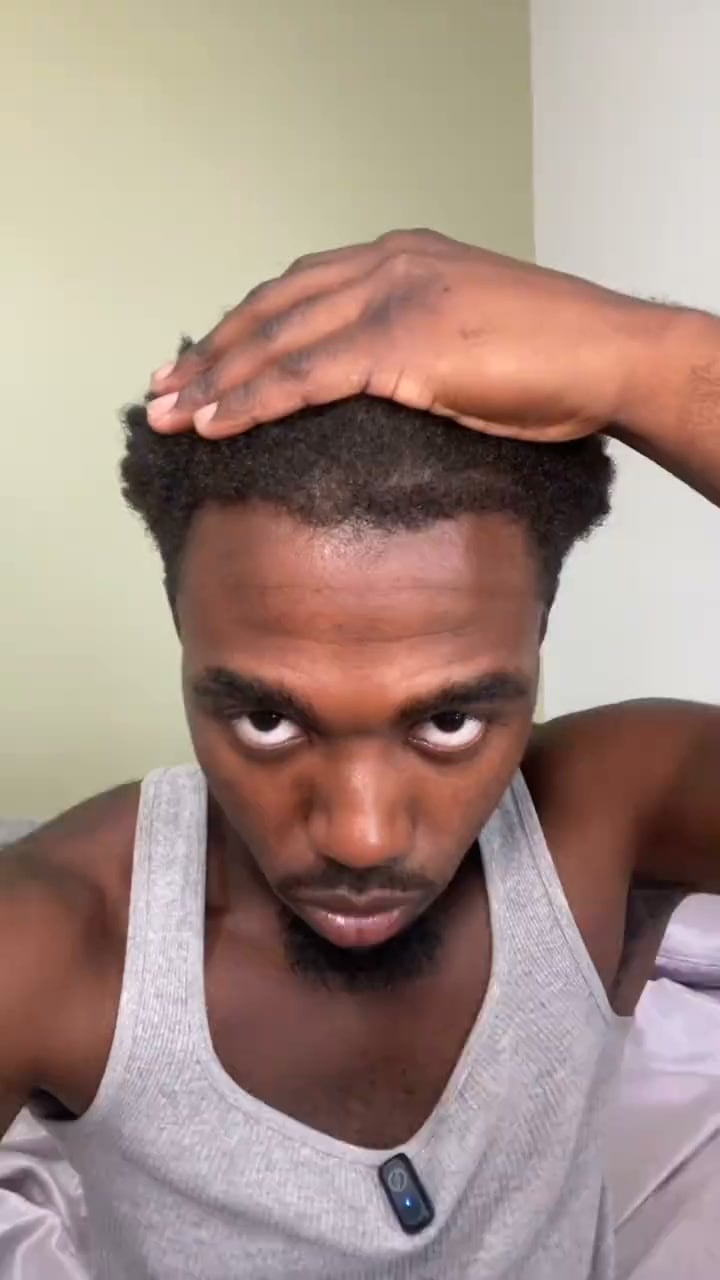 The serum that replaces minoxidil | 70% OFF Today