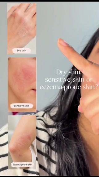 Bee-utiful Skin Starts Here!