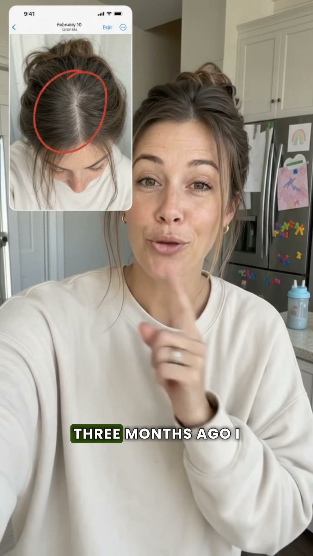The Missing First Step for Thinning Hair.