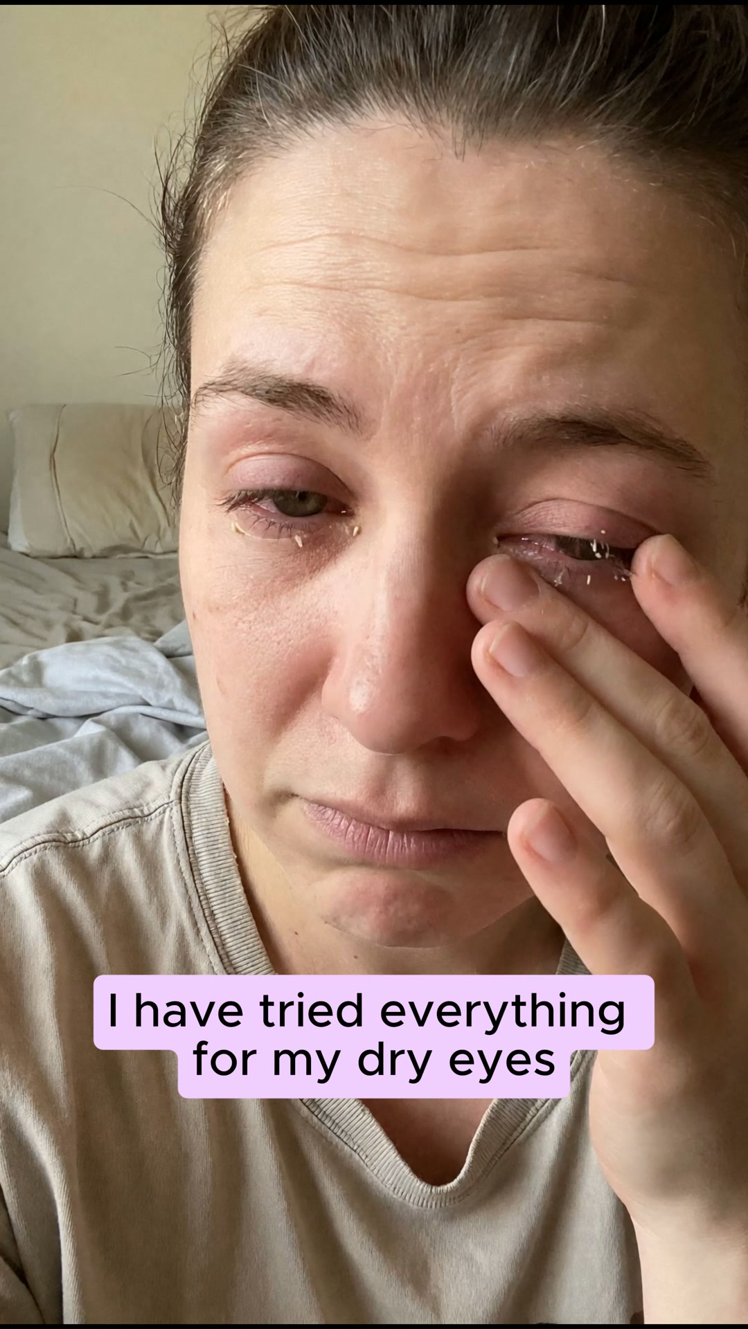 Never Use Eye Drops Again!