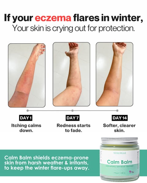 End the Struggle of Sore Skin for Good!