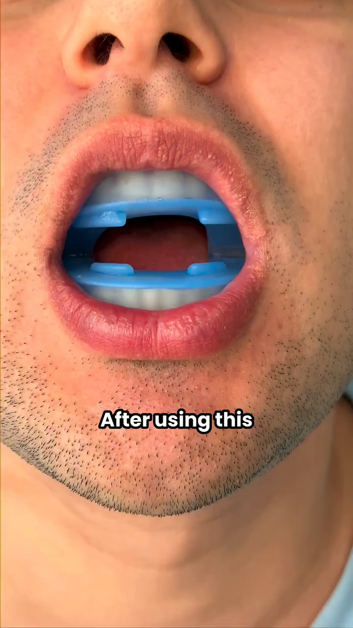 Stop Snoring. Sleep Better Tonight.