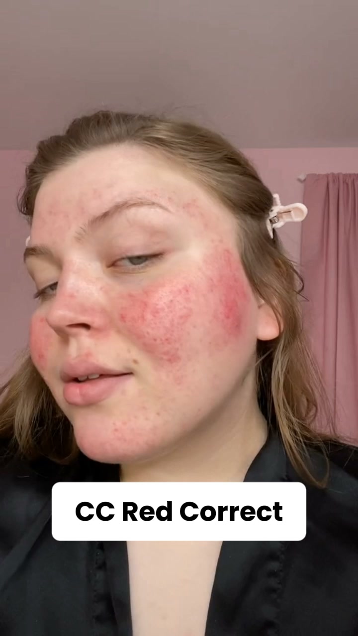 Instantly Erase Redness & Even Your Skin Tone