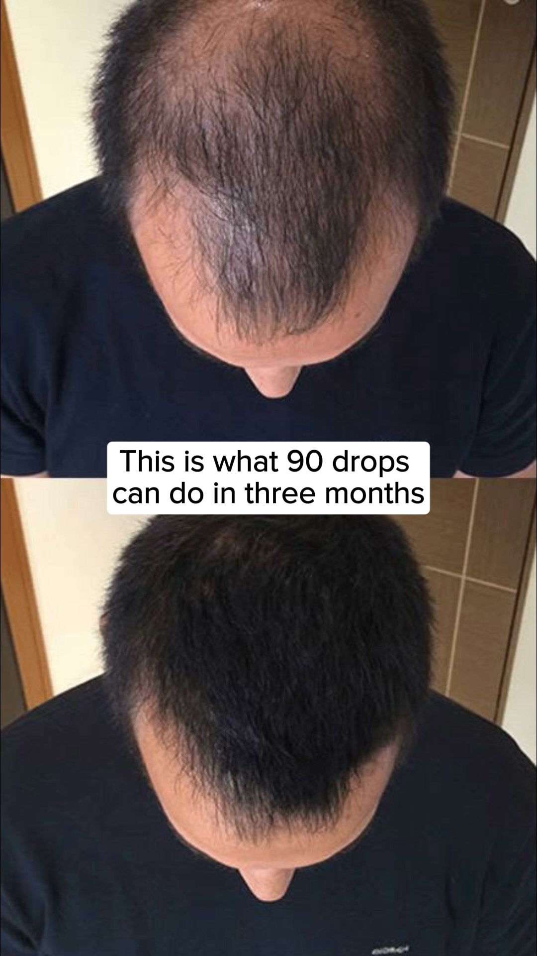 Korean Scalp Science, No Rx Needed