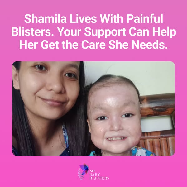 Shamila’s Skin Is Falling Off. Help Her.