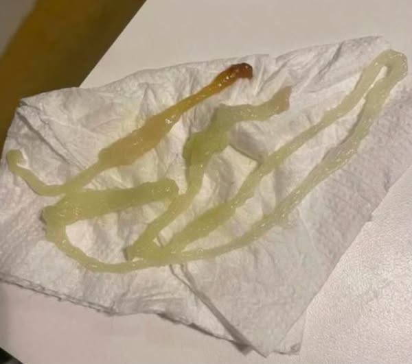 Why the Bible Warned About Parasites