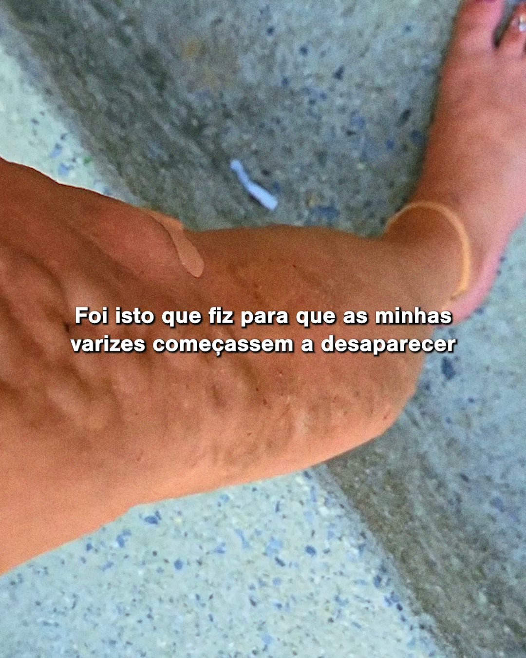 Cobrança Disponível
