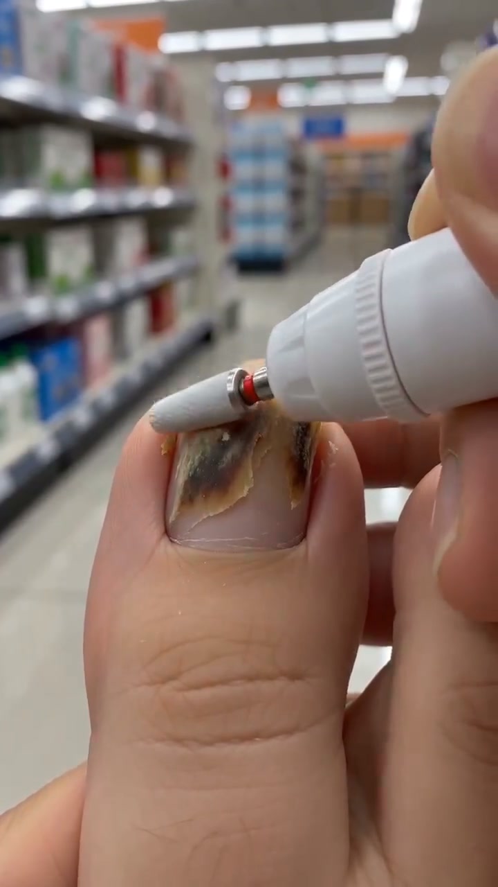 Thick Nails Shouldn’t Be This Hard to Manage