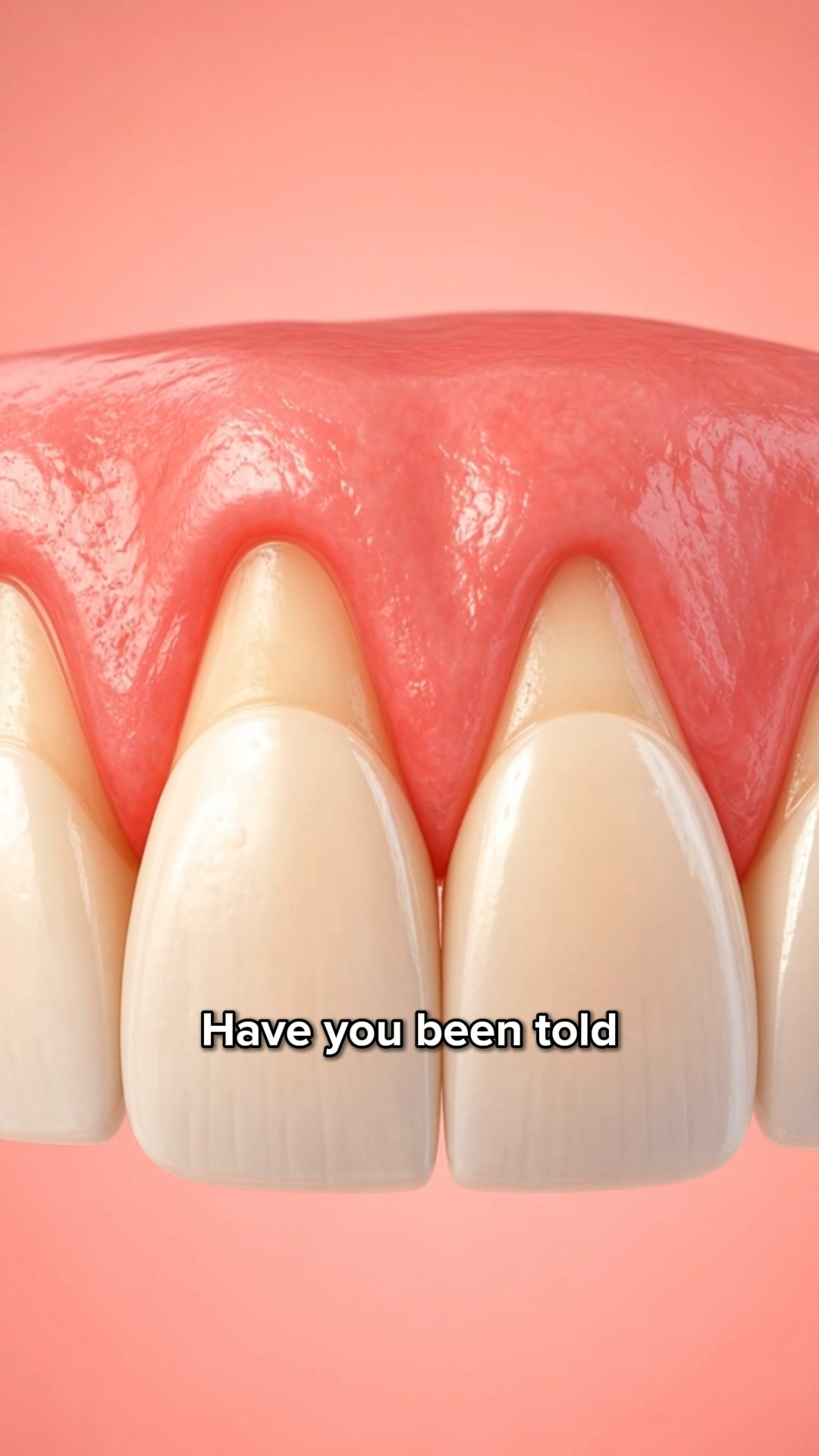 My Gums Kept Pulling Back