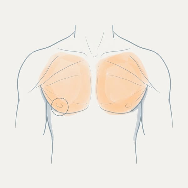 GPs Are Trained To Measure BMI. Not To Explain Why Your Chest Never Firmed Up.