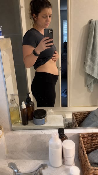 My best shot at fewer stretch marks