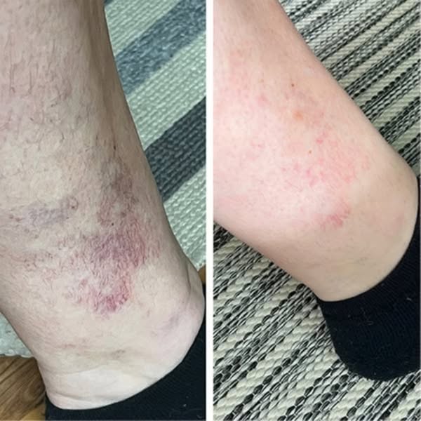 What Your Skin May Be Trying to Tell You