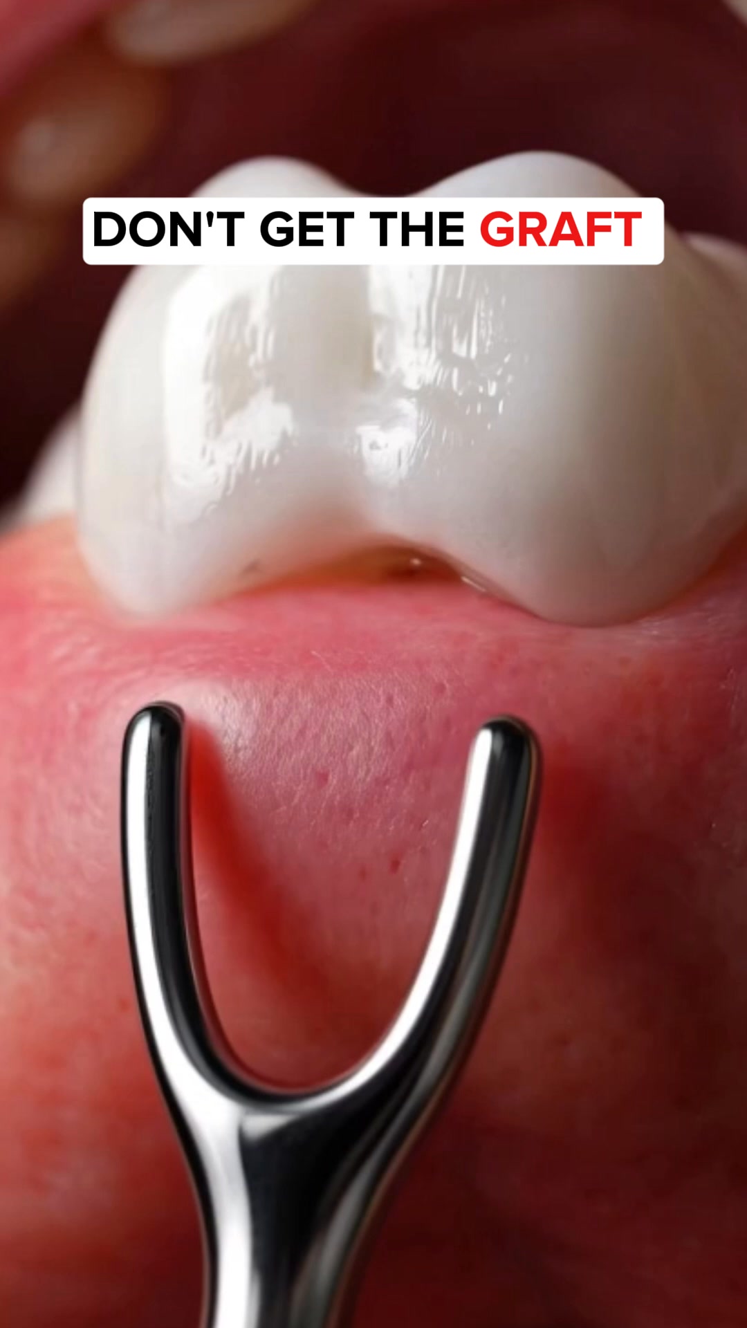 Periodontists Shocked By This Gum Gel — Here's Why