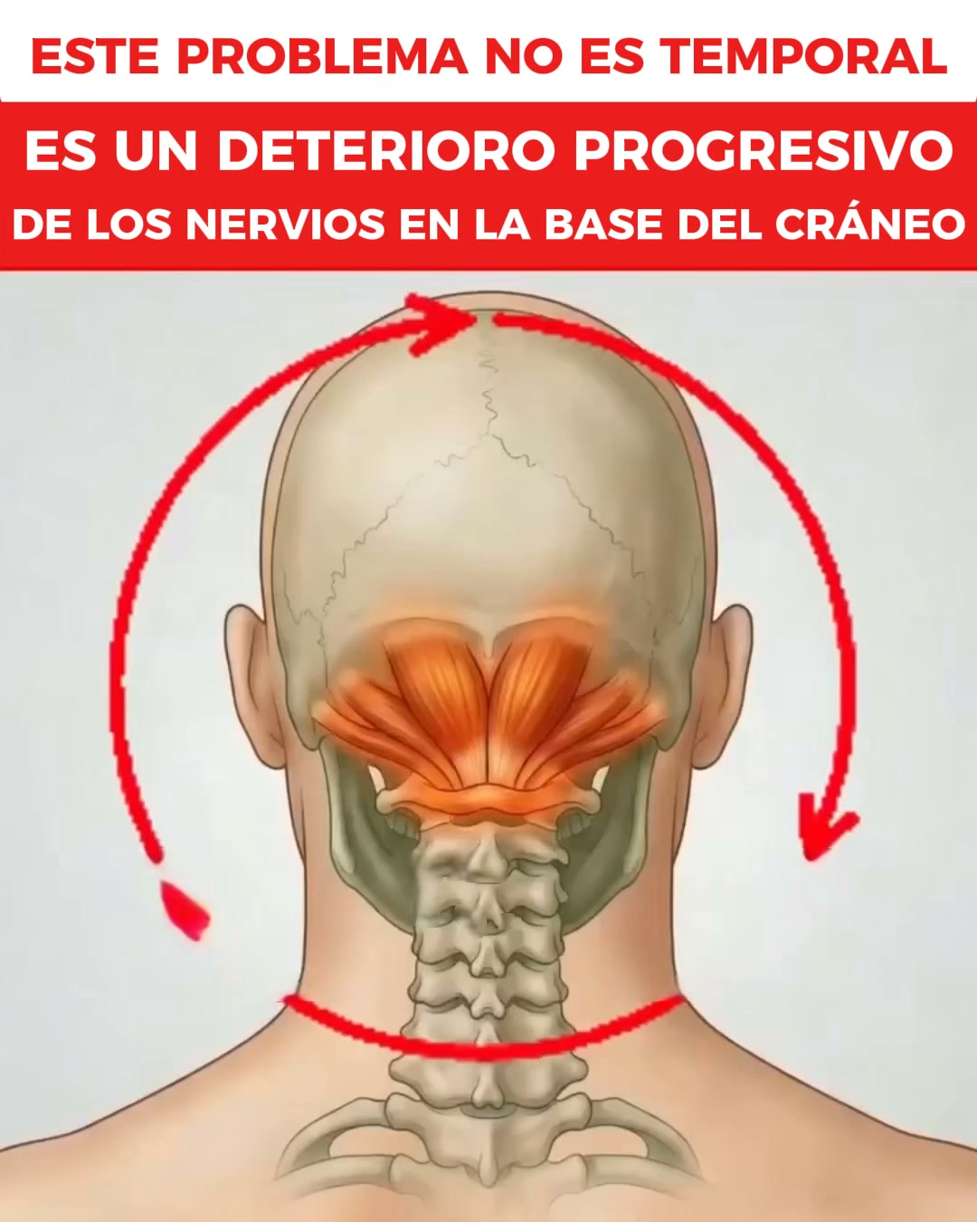 Empieza Leve, Luego Empeora