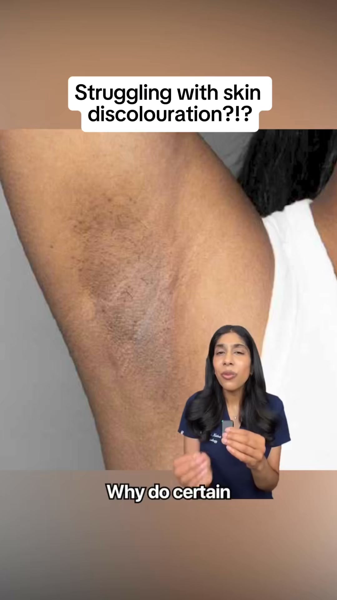 Brighter, More Even-Looking Skin