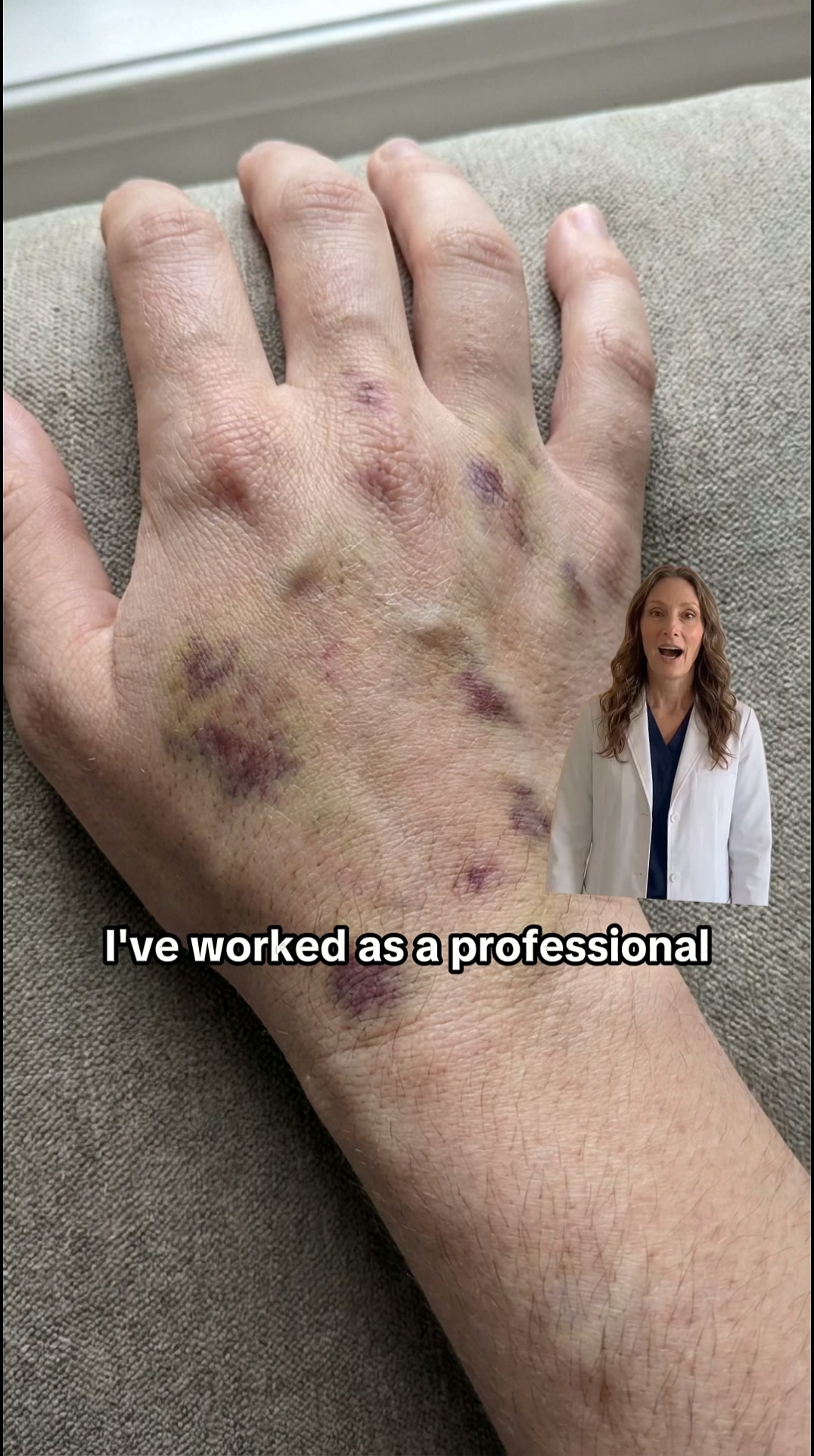 Bruises Gone In Days