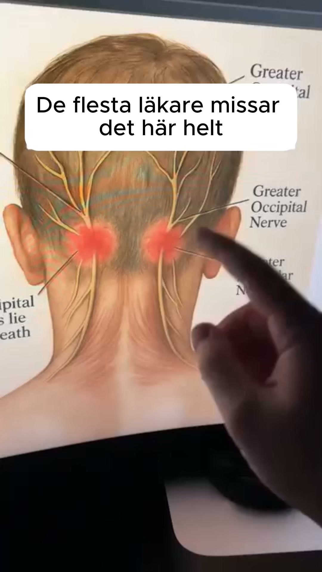 Släpp nacksmärtan på 15 minuter med CerviCare™