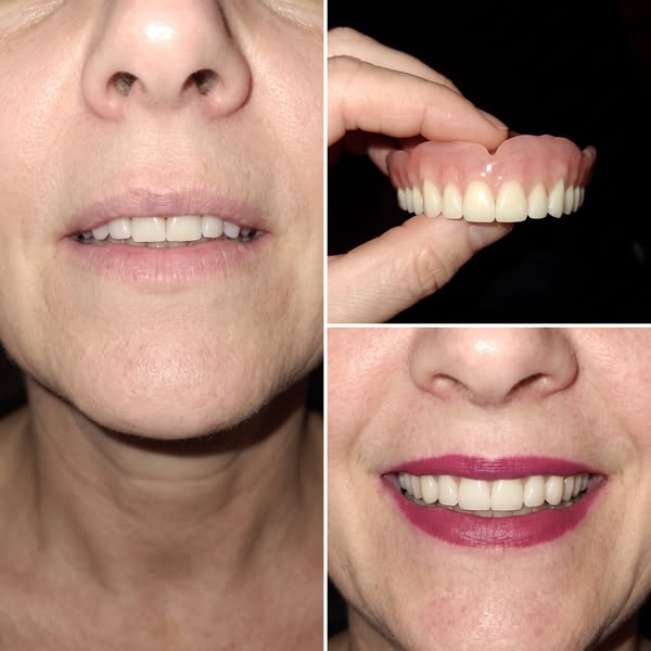 Lisez ceci si vous portez un dentier