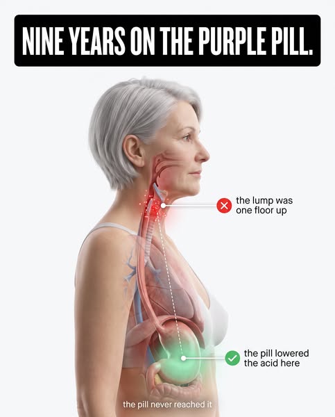 Nine Years On The Purple Pill. The Lump Never Once Left.