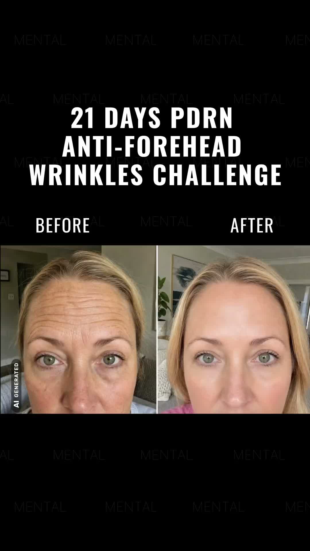 Start Now