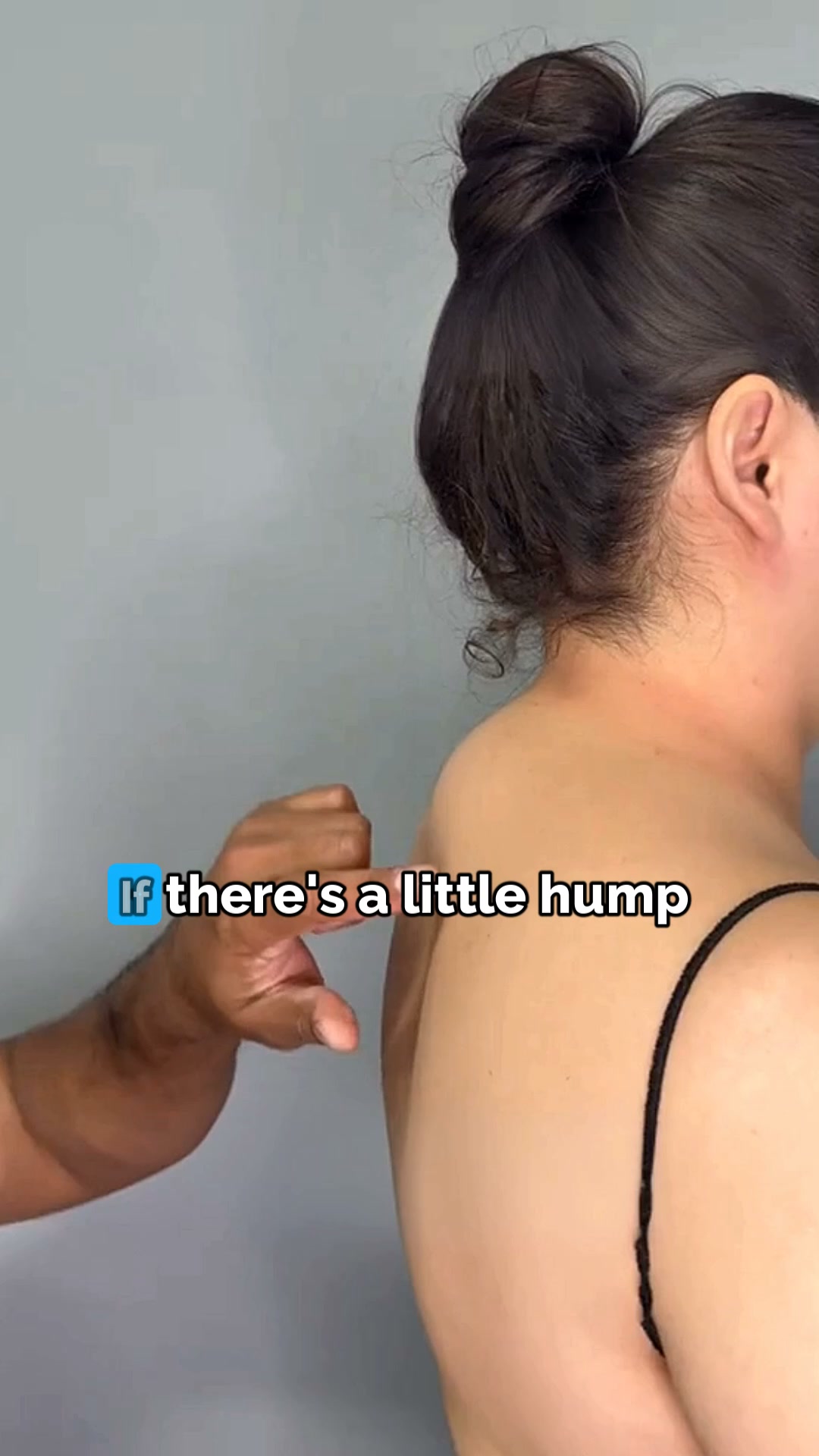 The Neck Hump Fix That Gets the Job Done!