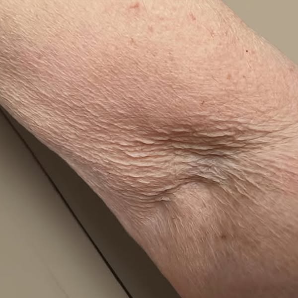Dermatologist Said There Was Nothing to Be Done. She Was Wrong
