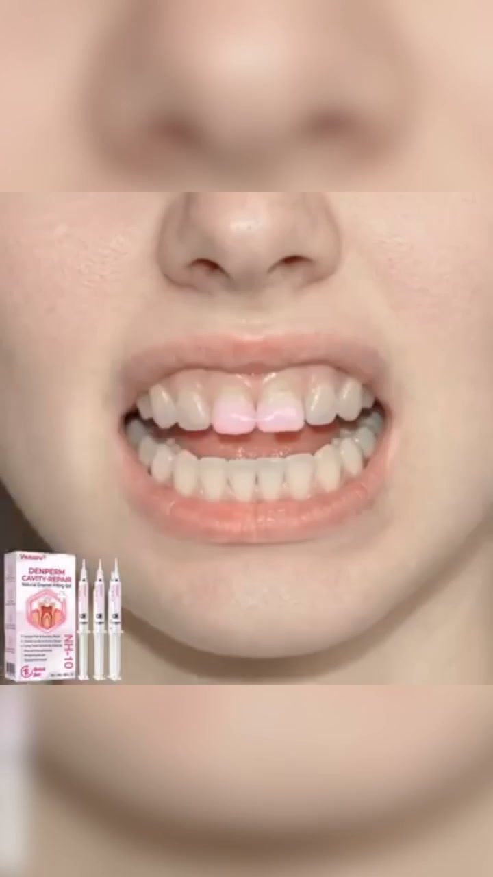 Cavity Repair LEDA-Recoanized 10% Nano-Hydroxyapatite (NH-10) LDelivery Within 2-4 Business Days | Full Money-Back Guarantee
