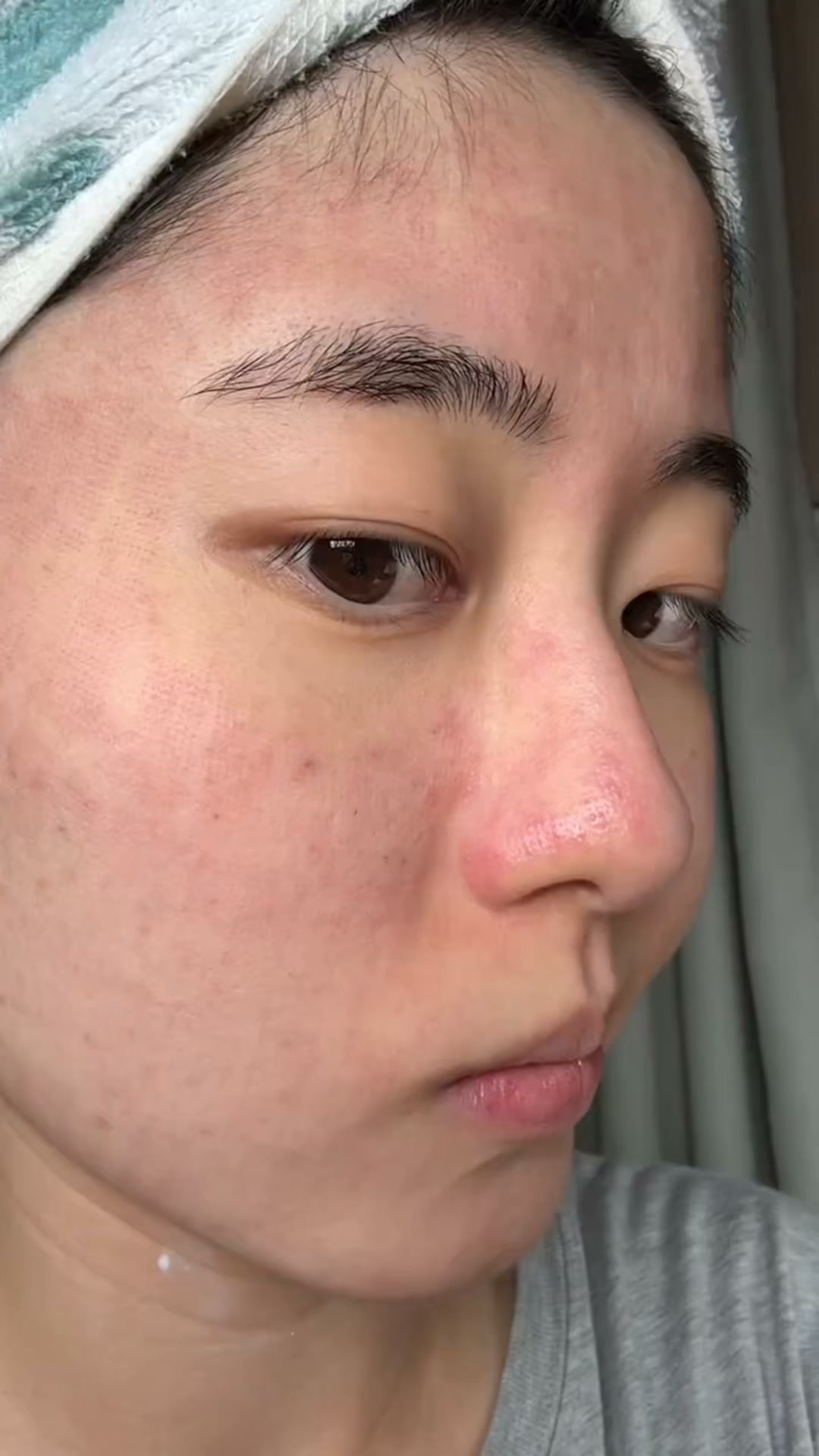 Calmer, Clearer-Looking Skin
