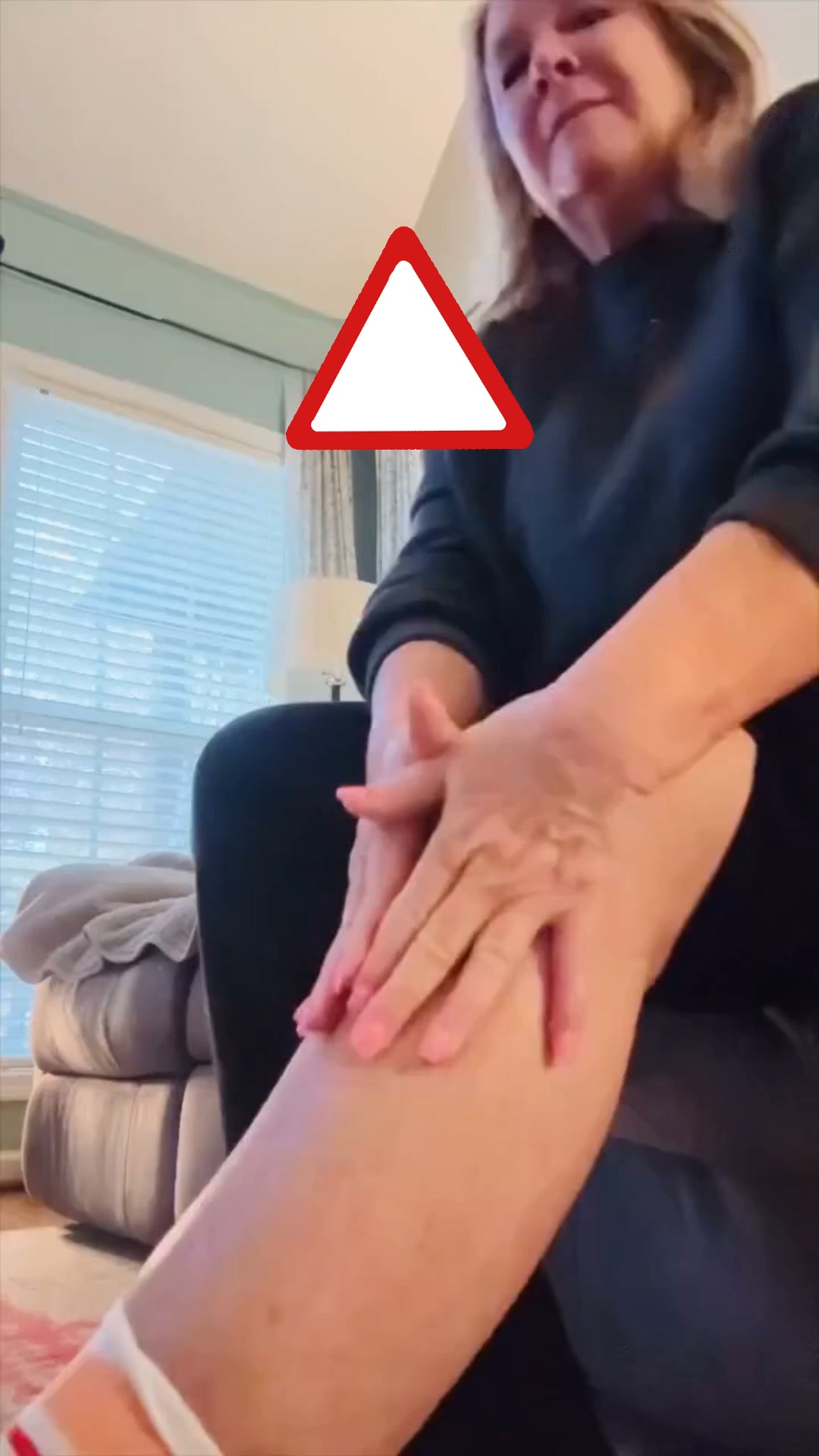 ¿Te sientes insegura por las arañitas vasculares en tus piernas?