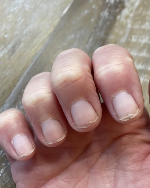 Read this if your nails are splitting...