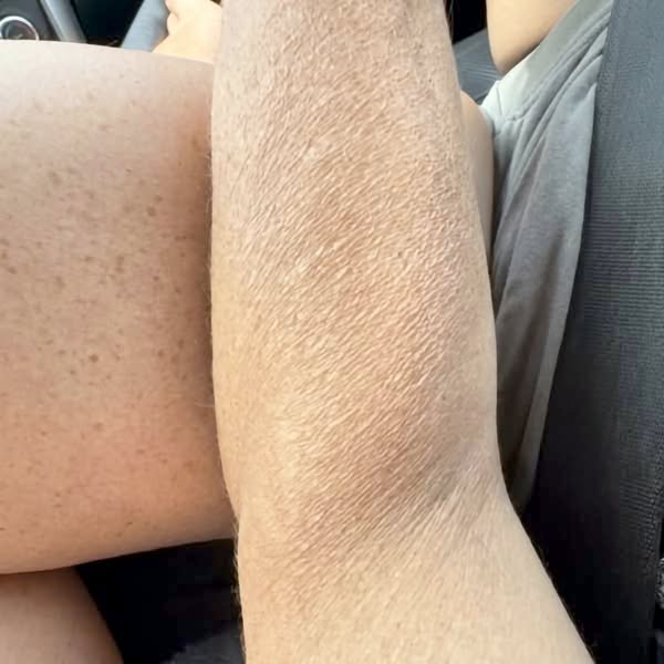 What The Jab Gives, Then Quietly Takes